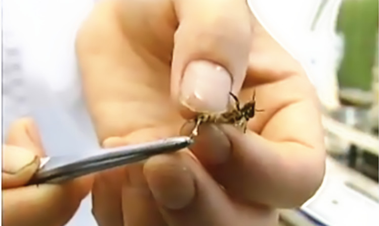 张先生：“贲门癌”蜂疗案例