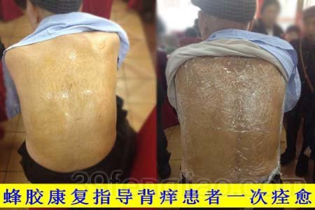 蜂产品的功效