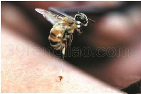 专家深度解读之直刺法