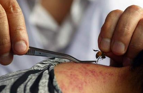 蜂毒多了对人体有害处吗？