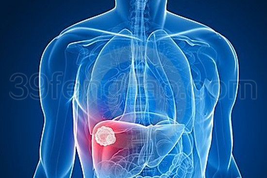 右上腹疼痛有可能是肝癌前兆