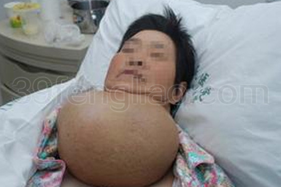 甲亢的常规治疗及辩证蜂疗