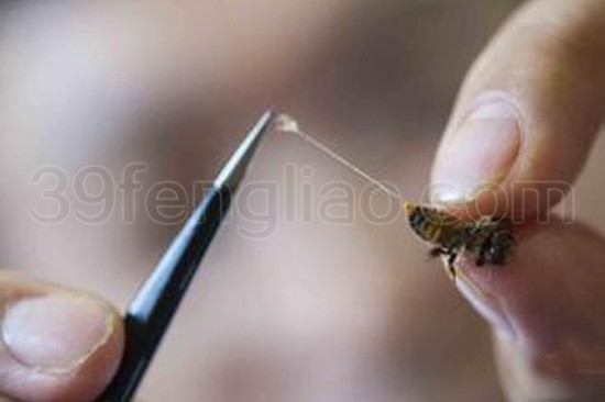 蜂疗的患者案例