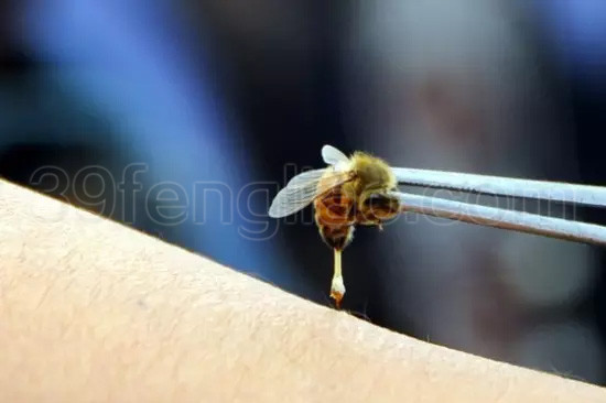 蜂疗治疗鼻炎效果显著