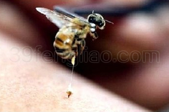 蜂针液(蜂毒)的神奇疗效