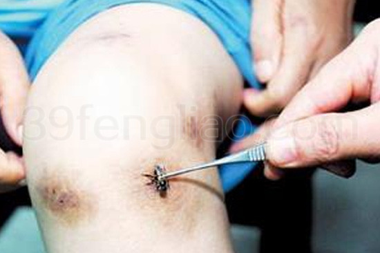 关元气海——补肾培元的要穴