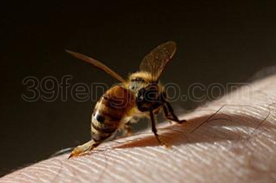 蜂针疗法安全性研究的思考与决策