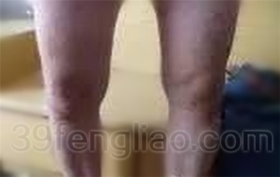 39蜂疗网，蜂疗