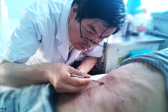 银质针与内热针治疗技术第一人——记兰州市中医医院风湿疼痛科主任、副主任医师李浩炜