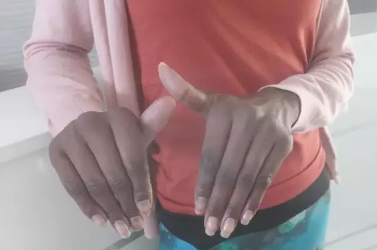 ReLife国际医疗中心让非洲姐妹感受中医的奇特