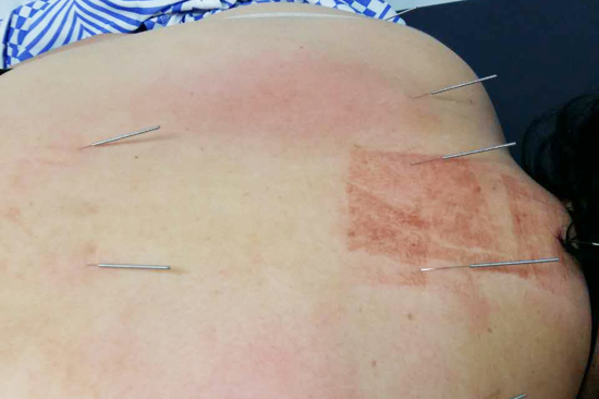 黎志光老师受邀参加蜂疗分会一届二次学术年会