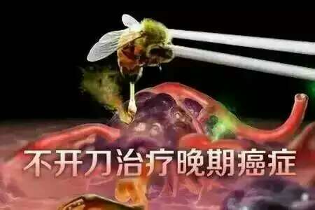 蜂针不开刀治癌症