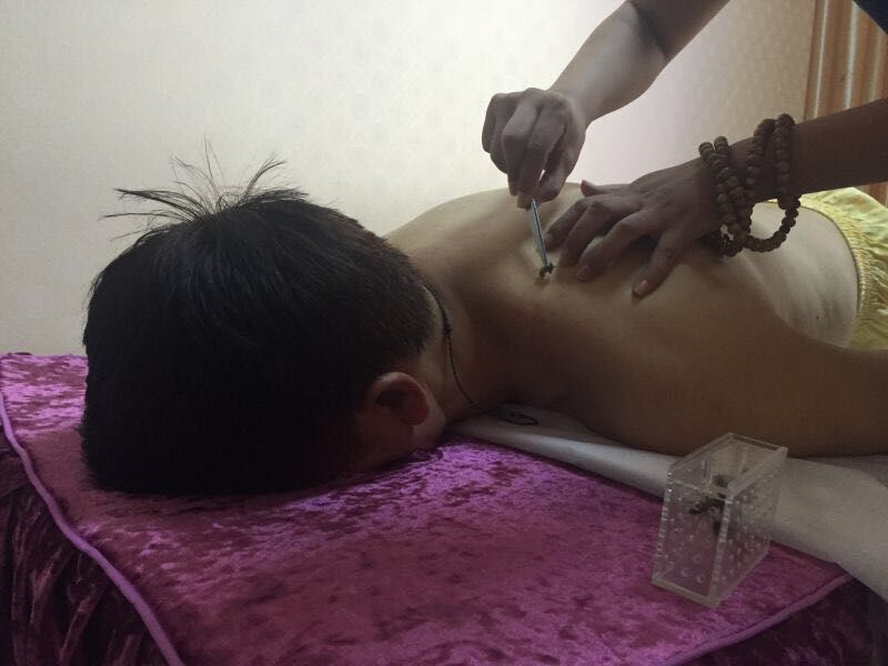 患者接受蜂肽疗法