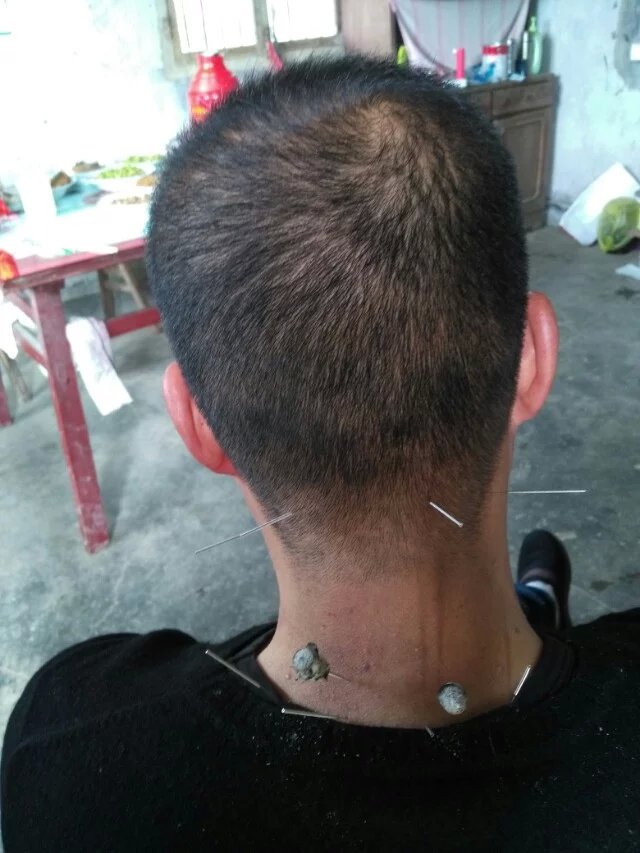 在乡下，为前来求治的邻居们治病。