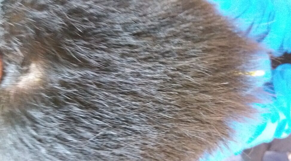 第4次蜂刺百会，内关。75点、76点。