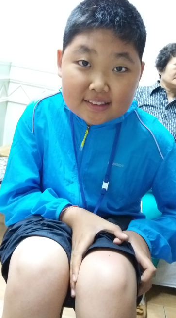 从家研12岁锦华小学学生两年前诊断类风湿病，来我们诊所后，当时不敢做蜂刺疗法。一直用激素治疗。