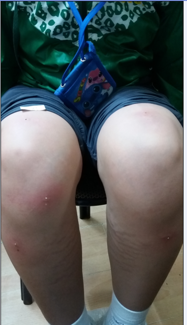 第3次蜂刺73点、74点、75点、76点。