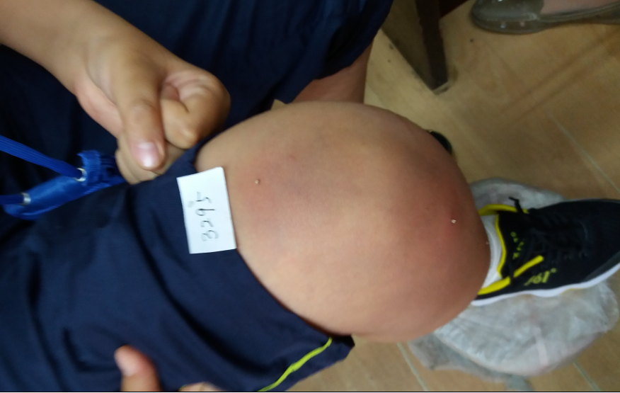 73点、75点、右腿双膝眼。